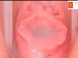 珍稀资源某美容美体医院内部流出高清内窥镜下女性阴道内部运动变化太粉嫩了怪不得肉棒都喜欢往里进 珍稀资源某美容美体医院内部流出高清内窥镜下女性阴道内部运动变化太粉嫩了怪不得肉棒都喜欢往里进